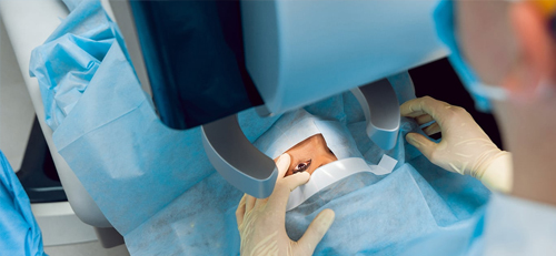 laser-eye-surgery-hurt